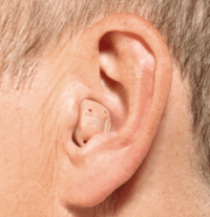 in the canal hearing aid in ear itc e1641803259225